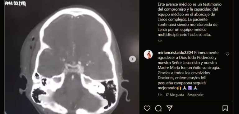 En IPS realizan exitoso bypass arterial en criatura para restablecer irrigación del cerebro